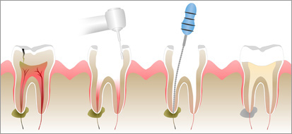 endodoncia clínica miguel lópez lora