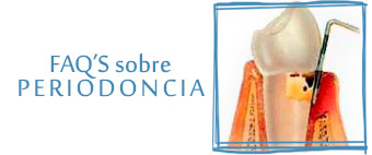 faqs sobre periodoncia clínica odontológica integral miguel lópez lora