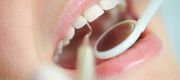 Endodoncia: ¿Qué es?