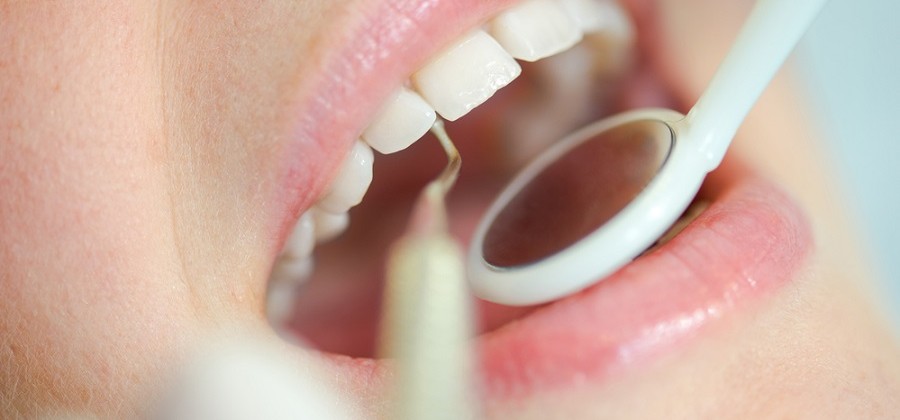 Endodoncia: ¿Qué es?