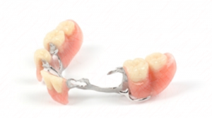 aparato dental removible